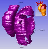 Left view of the cuhion tissue in the heart; the development of the AV-valves can be seen.