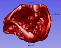 Caudal view of the common atrium in which the interatrial septum is developing