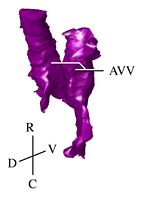 The developing AV-valves in the same orientation as the previous figure