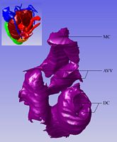 Overview of all cushion tissue lining the heart