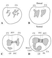Schematic drawings of transverse sections through the adult heart, starting near the apex, A, and progressing in the cranial direction up to the atrioventricular canal, D (based on White, 1968)